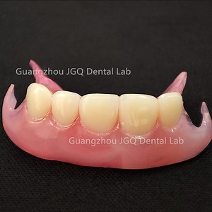 [Hot Item] Flexible Dentures Through CAD/Cam Software Durable Thinner More Comfortable