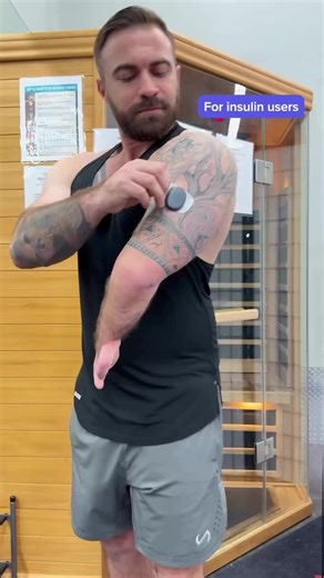 Adapting Your CGM for Insulin User Needs