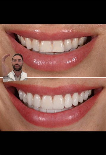 Advanced Bite Correction Techniques in Dentistry
