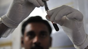 Scientists: Two-year-old 'cured' of HIV