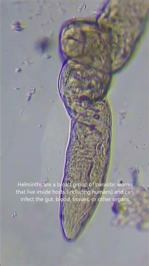 Helminths: The Creepy Worms Living Inside Us 🪱 #shorts