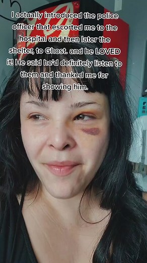 Personal Story of Resilience After a Concussion