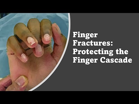 Finger Fracture Emergency Pearls
