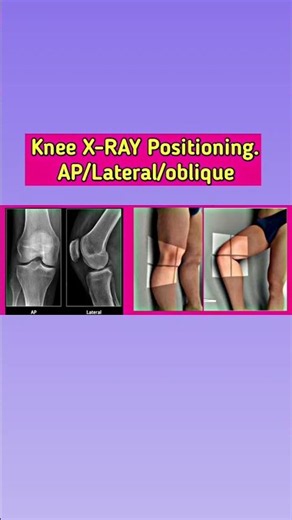Knee joint X-ray Positioning #radiographerusn #xray #radiology
