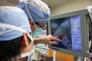 Deep Brain Stimulation (DBS) Treatment