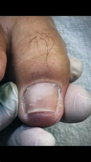 Professional Pedicure & Cuticle Care Tips for Healthy Nails