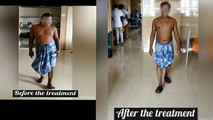 டிஸ்க் பல்ஜ், டிஸ்க் விலகி போச்சா?.. நடக்கவே முடியலையா?.. அரசு யோகா மருத்துவமனையில் சூப்பர் சிகிச்சை