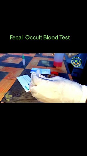 Understanding Fecal Occult Blood Test in Parasitology