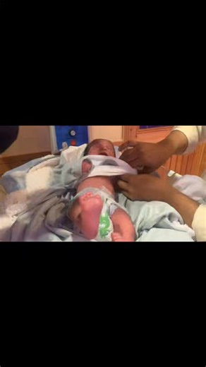 Newborn Baby Care After Delivery Room BabyDischarge #newborncare #nicuprocedure #nicucare #baby #viralchallenge #newbornbaby #cute Newborn Baby Care After Delivery Room | #BabyDischarge #NewbornCare Welcome to this heartwarming newborn care video! 💕 Watch the full process as the baby comes from the delivery room for observation, receives the Vitamin K (K lot) injection, goes through a complete check-up, and enjoys the first feed before finally being discharged home. 🏠 This video shows the love