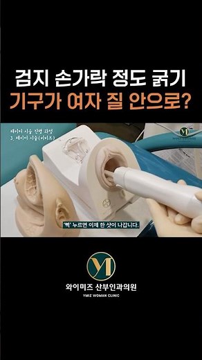 #여자 소중한 그곳🌸질 안으로 검지 손가락 정도 굵기??? #질레이저