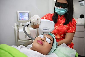 AFT Laser (IPL) - Rejuvie Aesthetic and Dermatology Bali