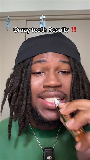 Teeth whitening on the go #teethwhitening #teethcare #whitening #teethwhiteningtips #teethwhiteningpen