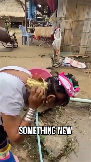 Why Neck Rings Are Dangerous 😱