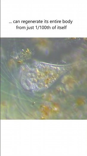 The kingdom of stentor creature! #microscopy #nature #biology #shorts