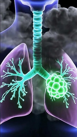 What Vaping Does to Your Lungs | The Damage Explained in 3D#Health#HealthAwareness#HealthTips