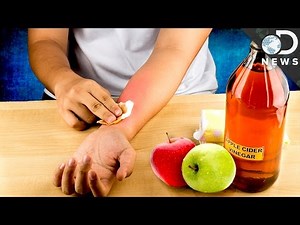 Is Apple Cider Vinegar A Miracle Cure?