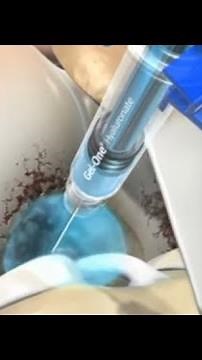 Ultrasound Guided Gel-One Injection