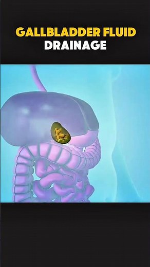 Gallbladder Fluid Drainage Explained | Cholecystostomy 🩺 #gallbladder #gallbladdersurgery #anatomy