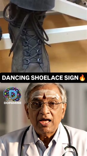 Dopamine on Instagram: "Dancing Shoelace Sign A subtle but important clinical clue pointing toward upper motor neuron involvement. Observation still remains a powerful diagnostic tool. 📲 Scan & Register | Limited Seats! Click here for Registration https://dopaminemed.com/ For assistance call 📱 Mobile: 9840711698 #ClinicalSigns #Neurology #DancingShoelaceSign #MedicalEducation #ClinicalExamination #NeuroSigns #Medicine"