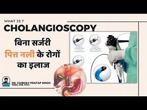 What is Cholangioscopy? | Complete Bile Duct Examination & Treatment