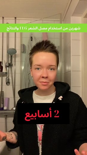 تجربتي مع بخاخ نمو الشعر من إف إي جي