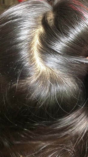 Majestic Fleas: The Most Attractive Creatures