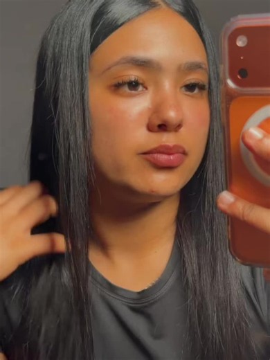 Never mind the pimples,it’s tht time of the month 😭#fyp