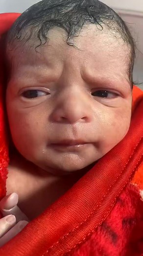 Cute Little Newborn Baby in NICU for Observation. This cute little newborn baby has been admitted to the NICU for observation . A peaceful and caring environment where nurses and doctors provide gentle care and monitoring to help the baby stay healthy and strong. This video is educational and aims to spread awareness about NICU observation and newborn care. #NICUDischarge #NewbornCare #BabyObservation #NICUNurse #DischargeProcess #HealthyBaby #NeonatalCare #BabyCareTips #NICULife #HospitalCare #