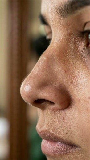 Rhinoplasty Surgery: Nose Reshaping for Better Facial Balance