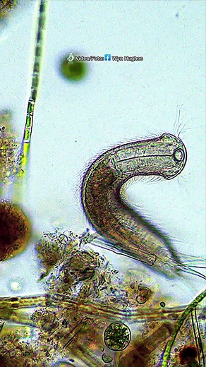 Gastrotricos: Organismos Acuáticos Fascinantes