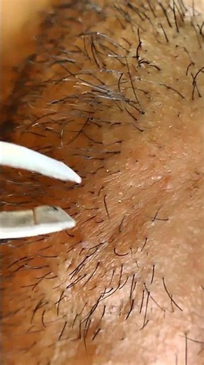 Beard Grooming Secrets Effective Plucking Methods1