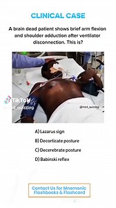 Comment “Details” and check your inbox for the full mnemonic flashbook & flashcards! 📕✨ . . . . #medical #medicine #medicalstudent #nursing #usmle