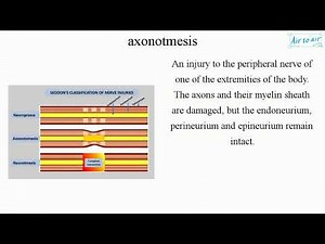 axonotmesis