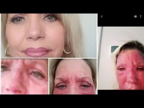 THOUSANDS of Targeted Individuals worldwide