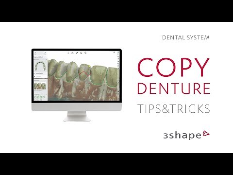 3Shape Dental System - Copy denture tips and tricks