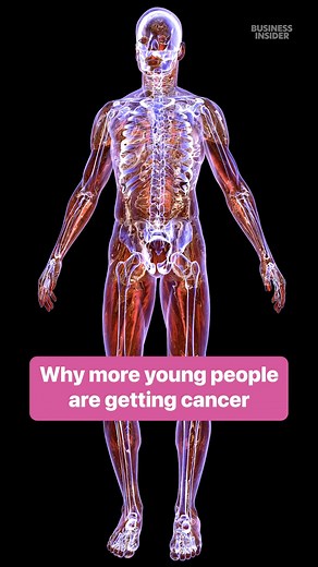 Cancer rates in younger people are rising sharply worldwide. Diet, inactivity, and poor sleep could all play a role. #Health #Cancer #Cancerawareness | Insider Science