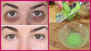 711K views · 10K reactions | How To Remove Dark Circles Permanently - काले घेरों को रातों रात खत्म करने का सबसे आसान चमत्कारी नुस्खा Join: Simple Beauty Secrets | Simple Beauty Secrets | Facebook