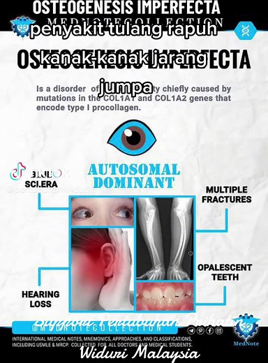 Understanding Osteogenesis Imperfecta: Causes and Types