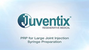 How to Properly Prepare a Syringe of PRP with Juventix