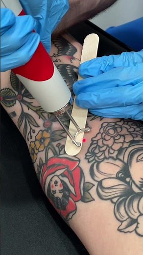 Tattoo BLOWOUT Cleanup | Selective Laser Tattoo Removal #tattooremoval #lasertattooremoval #tattoo