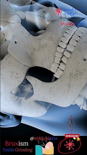 Teeth Grinding 😬 Bruxism 😬 Teeth Grind Sound 🦷