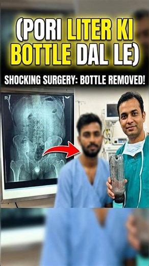 Taj Mahal nahi, ye hai Agra ka asli adventure! 😲 #facts