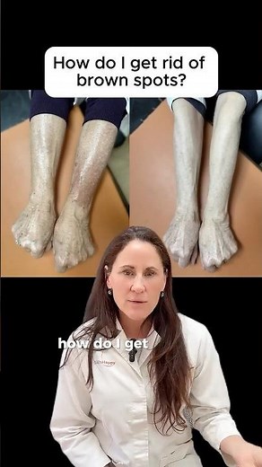 Derm Explains: The Best Way to Treat “Age Spots”