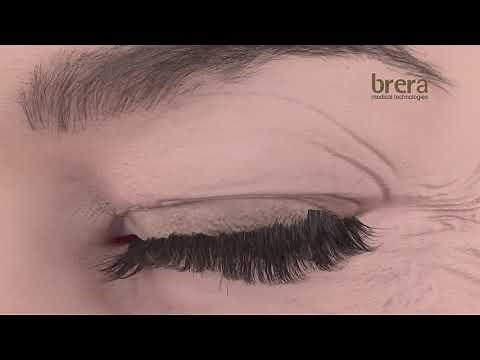 How Plasmage works for the treatment of non-invasive blepharoplasty (blefaroplastica)