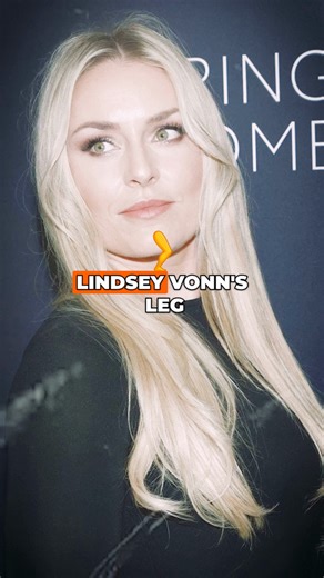 Lindsey Vonn Reveals Shocking Leg Injury After Olympic Crash Nightmare Lindsey Vonn’s Winter Olympics comeback ended in disaster after a horrific downhill crash left her leg nearly amputated. The Team USA legend revealed shocking details about her surgery and recovery, including severe muscle loss. Here’s the full injury update and emotional aftermath. Subscribe to the channel for more Sports updates! #LindseyVonn #WinterOlympics #OlympicNews #TeamUSA #SportsFans #BreakingSports | Sportskeeda US