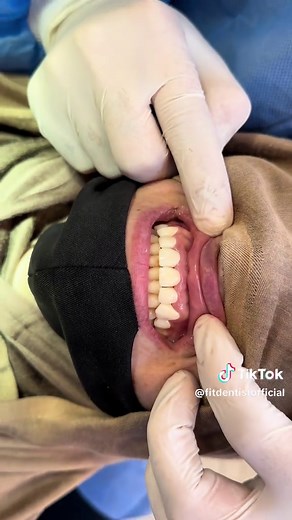 Discover the Beauty of 3D Modeling for Dental Health