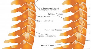 This Amazing Breakthrough Has Given Hope to Quadriplegics