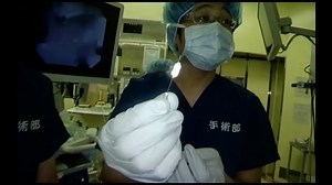 A novel guidewire technique for endobronchial silicone plug occlusion for bronchopleural fistula