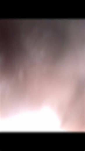 🔥🫵🏼#thequeenofbraidsindili #timorleste🇹🇱❤foryoupage