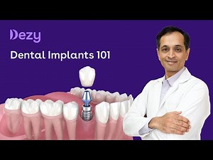 Dental Implants 101: Your Comprehensive Guide by Dezy Dentist!